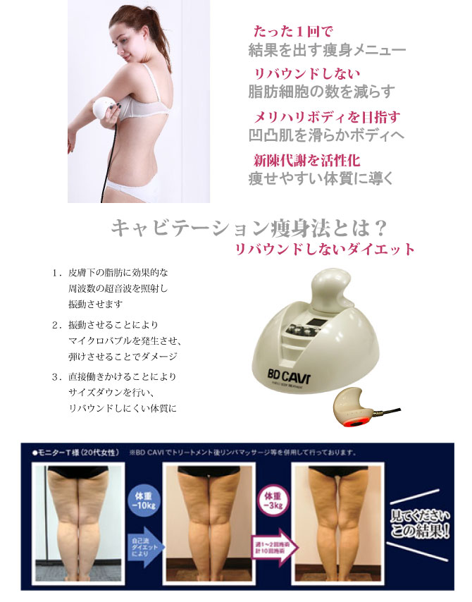 �L���r�e�[�V����